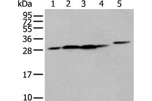 Western blot analysis of 293T cell Human fetal liver tissue A549 and Hepg2 cell using FKBP7 Polyclonal Antibody at dilution of 1:400 (FKBP7 antibody)