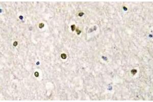 Immunohistochemistry (IHC) analyzes of CRSP77 antibody in paraffin-embedded human brain tissue. (MED17 antibody)