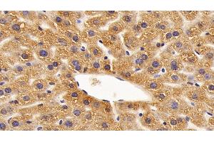 Immunohistochemistry (IHC) image for anti-Tumor Necrosis Factor (Ligand) Superfamily, Member 8 (TNFSF8) (AA 68-231) antibody (ABIN7431086)
