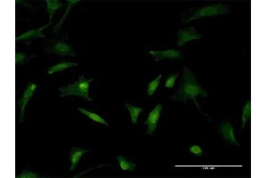 Immunofluorescence of monoclonal antibody to TLN1 on HeLa cell. (TLN1 antibody  (AA 1324-1424))