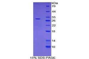 SDS-PAGE analysis of Human CLEC13A Protein. (DCL1 Protein)