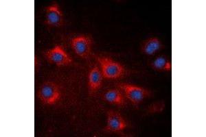 Immunofluorescent analysis of RPS20 staining in A549 cells. (RPS20 antibody)