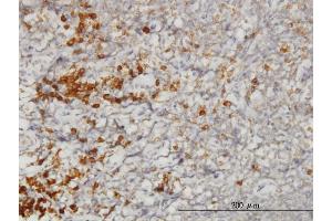 Immunoperoxidase of monoclonal antibody to SSR1 on formalin-fixed paraffin-embedded human tonsil. (SSR1 antibody  (AA 33-286))