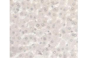 IHC-P analysis of Rat Liver Tissue, with DAB staining. (Androgen Receptor antibody  (AA 491-679))