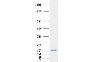 C2orf40 Protein (Myc-DYKDDDDK Tag)