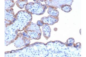 Immunohistochemistry (IHC) image for anti-Epidermal Growth Factor Receptor (EGFR) antibody (ABIN6939295)