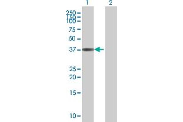 ETV7 antibody  (AA 1-341)
