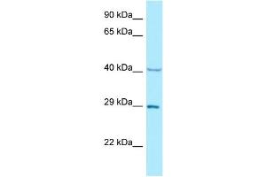 WB Suggested Anti-NCK1 Antibody Titration: 1. (NCK1 antibody  (N-Term))