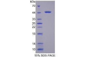 Image no. 1 for Heat Shock 70kDa Protein 6 (HSP70B') (HSPA6) (AA 1-387) protein (His tag) (ABIN6238517) (HSPA6 Protein (AA 1-387) (His tag))