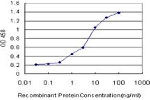 Detection limit for recombinant GST tagged ACADVL is approximately 0. (ACADVL antibody  (AA 345-434))