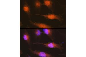 Immunofluorescence analysis of U-251 MG cells using Huntingtin Rabbit pAb (ABIN7267794) at dilution of 1:100 (40x lens). (Huntingtin antibody)