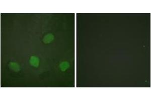 Immunofluorescence analysis of HeLa cells, using CREB (Phospho-Ser142) Antibody.