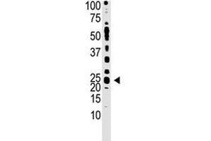 Image no. 1 for anti-Teratocarcinoma-Derived Growth Factor 1 (TDGF1) (N-Term) antibody (ABIN357430)