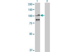 Western Blotting (WB) image for anti-Actinin, alpha 4 (ACTN4) (AA 592-701) antibody (ABIN559759)