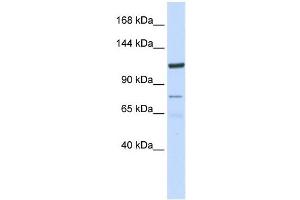 KIAA1324 antibody used at 1 ug/ml to detect target protein.