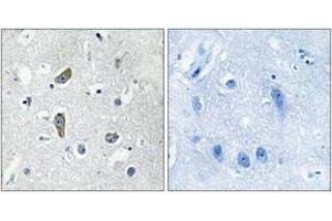 Immunohistochemistry analysis of paraffin-embedded human brain, using CDK5RAP2 Antibody. (CDK5RAP2 antibody  (AA 251-300))