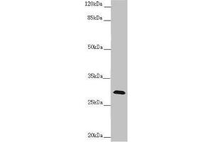 Western blot All lanes: CENPH antibody at 1. (CENPH antibody  (AA 1-247))