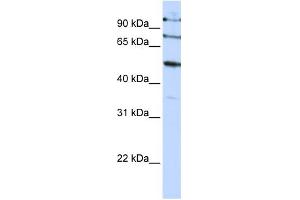 WB Suggested Anti-FBXO5 Antibody Titration:  0. (FBXO5 antibody  (C-Term))