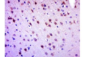 Paraformaldehyde-fixed, paraffin embedded rat brain, Antigen retrieval by boiling in sodium citrate buffer (pH6. (C6ORF120 antibody)