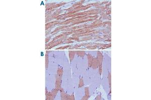 Immunohistochemical analysis of paraffin-embedded human skeletal muscle (A) and cardiac muscle (B) using MYL3 monoclonal antibody, clone 7C1  with DAB staining.