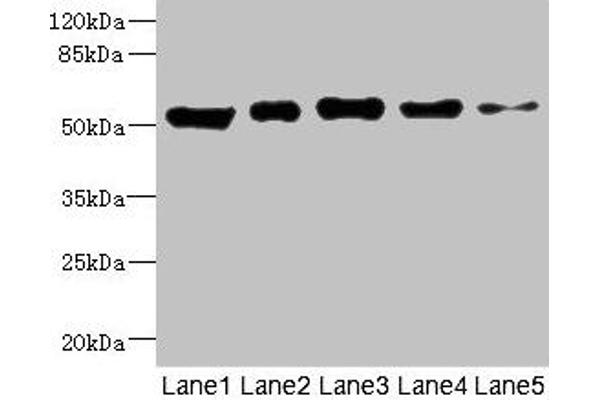 GIPR antibody  (AA 22-138)