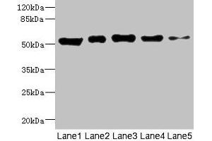 Western blot All lanes: GIPR antibody at 5.