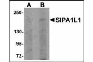 Western blot analysis of SIPA1L1 in rat brain tissue lysate with SIPA1L1 antibody at (A) 0.