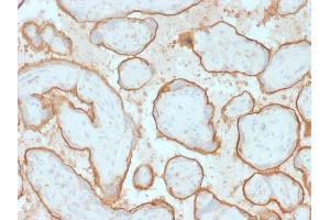 Immunohistochemistry (IHC) image for anti-Epidermal Growth Factor Receptor (EGFR) (AA 344-492) antibody (ABIN6939284)