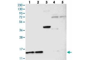 Western blot analysis of Lane 1: RT-4, Lane 2: U-251 MG, Lane 3: Human Plasma, Lane 4: Liver, Lane 5: Tonsil with C22orf40 polyclonal antibody  at 1:250-1:500 dilution. (CDPF1 antibody)