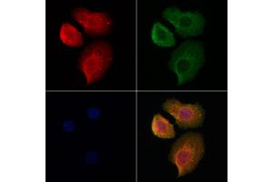 ABIN6262153 and ABIN6278025 staining Hela cells by IF/ICC. (HBA1 antibody  (Internal Region))