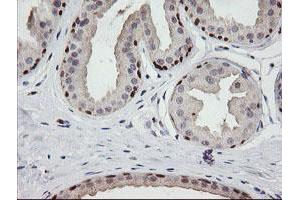 Image no. 4 for anti-Chromosome 2 Open Reading Frame 62 (C2orf62) antibody (ABIN1497053) (C2orf62 antibody)