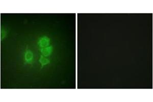 Immunofluorescence analysis of HuvEc cells, using MSK1 Antibody . (MSK1 antibody  (Internal Region))