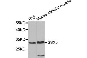 Western blot analysis of extracts of various cell lines, using SSX5 antibody.