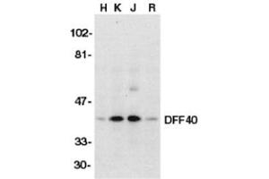 Western blot analysis of DFF40 in HeLa (H), K562 (K), Jurkat (J), and Raji (R) whole cell lysate with AP30286PU-N DFF40 antibody (I18) at 1/500 dilution.