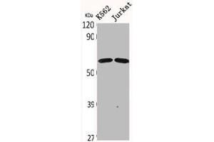 Western Blot analysis of K562 Jurkat cells using CDYL2 Polyclonal Antibody (CDYL2 antibody  (N-Term))