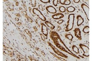 ABIN6259871 and ABIN6269218 at 1/100 staining Human kidney tissue by IHC-P.