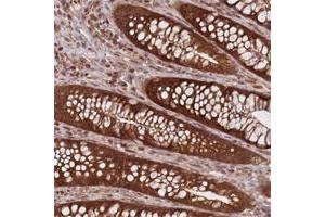Immunohistochemical staining of human stomach with CXorf57 polyclonal antibody  shows strong nuclear, cytoplasmic and membranous positivity in glandular cells. (CXORF57 antibody)