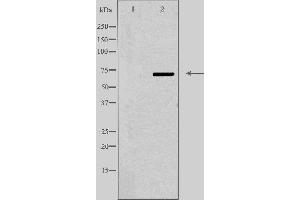Western blot analysis of extracts from HepG2 cells, using ABCD4 antibody. (ABCD4 antibody  (Internal Region))