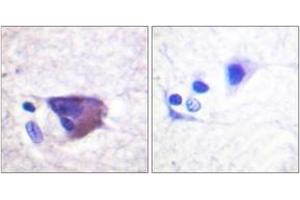 Immunohistochemistry analysis of paraffin-embedded human brain, using Kv2. (Kv2.1/KCNB1 antibody  (pSer567))