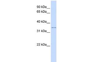 WB Suggested Anti-KCNRG Antibody Titration:  0. (KCNRG antibody  (Middle Region))