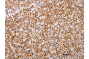 Immunoperoxidase of monoclonal antibody to RIPK4 on formalin-fixed paraffin-embedded human liver. (RIPK4 antibody  (AA 675-784))