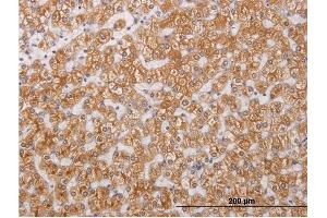 Immunoperoxidase of monoclonal antibody to RIPK4 on formalin-fixed paraffin-embedded human liver.