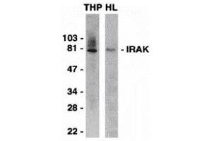 Western Blotting (WB) image for anti-Interleukin-1 Receptor-Associated Kinase 1 (IRAK1) (C-Term) antibody (ABIN1030443) (IRAK1 antibody  (C-Term))