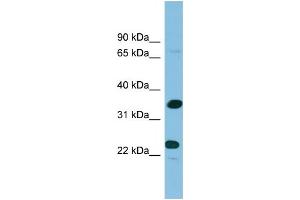 WB Suggested Anti-PDYN Antibody Titration: 0. (PDYN antibody  (Middle Region))