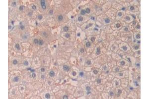 DAB staining on IHC-P; Samples: Human Liver Tissue (desert Hedgehog antibody  (AA 241-383))