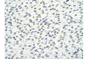 Rabbit Anti-KHDRBS1 antibody Catalog Number: ARP40665  Paraffin Embedded Tissue: Human Heart cell Cellular Data: cardiac cell of renal tubule Antibody Concentration: 4. (KHDRBS1 antibody  (N-Term))