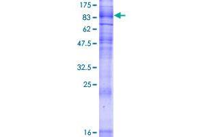 SLC5A2 Protein (AA 1-672) (GST tag)