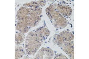 Immunohistochemistry of paraffin-embedded human stomach using MAP3K5 antibody (ABIN1873618) (40x lens). (ASK1 antibody)
