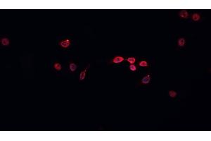 ABIN6266587 staining HeLa  cells by IF/ICC. (MCM5 antibody  (N-Term))