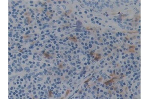 Prekallikrein antibody  (AA 156-364)